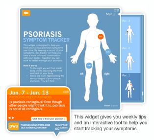 Abbott launches website, widget for psoriasis awareness Abbott launches website, widget for psoriasis awareness