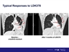 Novartis readying 2014 filing for lung cancer drug