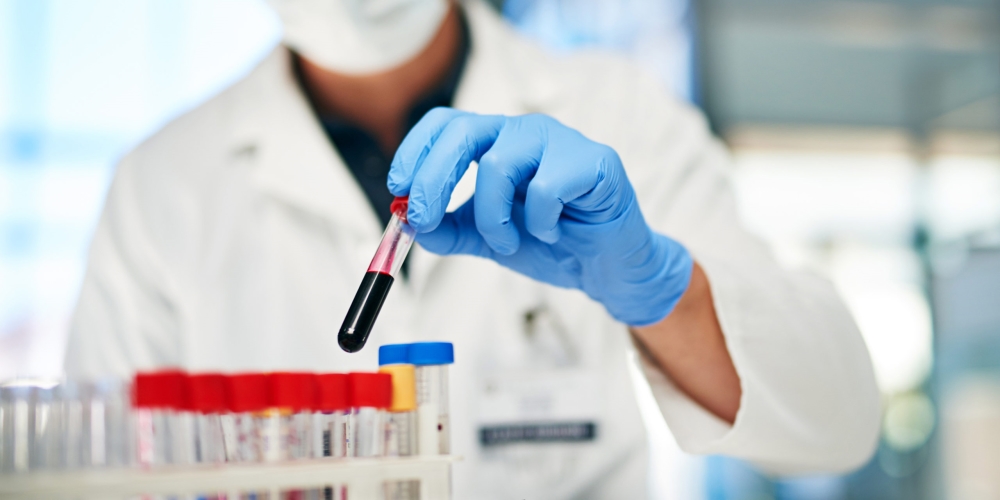 Celgene in talks to buy Juno Therapeutics