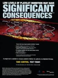 Ad omits lack of evidence on platelet-function testing Ad omits lack of evidence on platelet-function testing