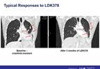 Novartis readying 2014 filing for lung cancer drug Novartis readying 2014 filing for lung cancer drug