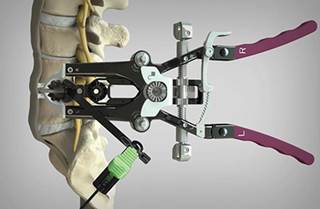 Infuse Medical works with most of the Fortune 1000 device companies Infuse Medical works with most of the Fortune 1000 device companies