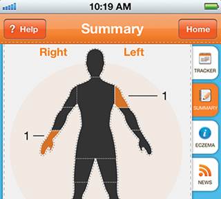The Eczema App The Eczema App