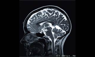 As ADHD climbs, diagnostics mount As ADHD climbs, diagnostics mount