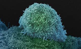 Oncology is expected to be a growing market. Oncology is expected to be a growing market.