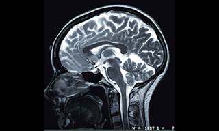 Study finds Alzheimer's misunderstood Study finds Alzheimer's misunderstood