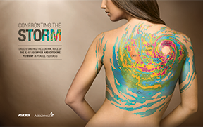 GSW targeted dermatologists about a new MOA for treating psoriasis in this Amgen ad campaign GSW targeted dermatologists about a new MOA for treating psoriasis in this Amgen ad campaign