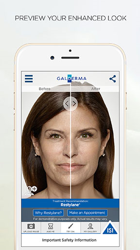 IOMEDIA's patient app for Galderma's Restylane IOMEDIA's patient app for Galderma's Restylane