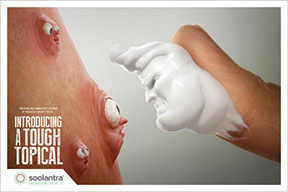 McCann Echo took on rosacea with its ad for Soolantra (ivermectin) McCann Echo took on rosacea with its ad for Soolantra (ivermectin)