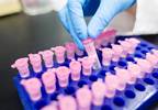Five things for pharma marketers to know: Thursday, February 2, 2017 Five things for pharma marketers to know: Thursday, February 2, 2017