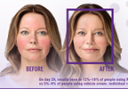 Allergan ramps up promotion for new rosacea drug Allergan ramps up promotion for new rosacea drug