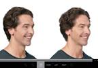 Allergan's Botox sets its sights on a new customer: men Allergan's Botox sets its sights on a new customer: men
